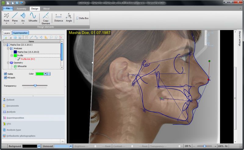 Viewing software / medical / for dental imaging AudaxCeph Essentials Audax d.o.o.