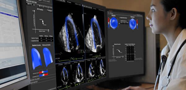 Diagnostic software / viewing / for ultrasound imaging / medical EchoInsight® Epsilon