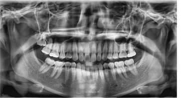 Panoramic X-ray system (dental radiology) / dental CBCT scanner / digital PaX-Zenith3D VATECH