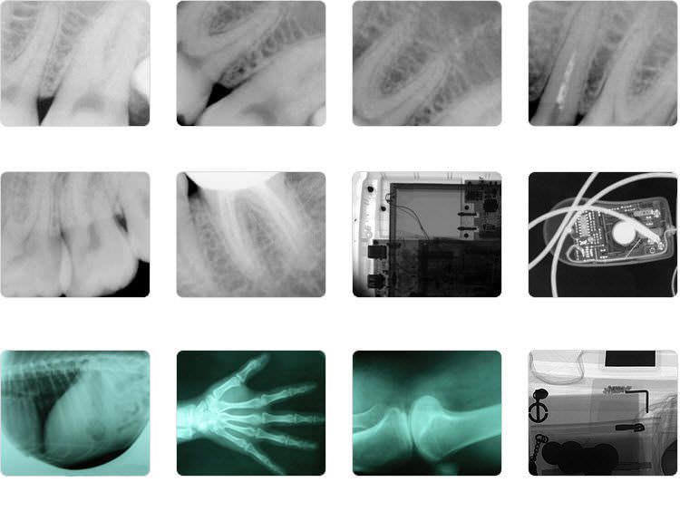 Dental x-ray generator (dental radiology) / digital / handheld iRay D3 DEXCOWIN CO. LTD