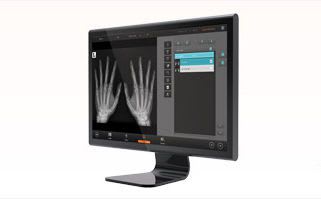 Reporting software / analysis / medical imaging / medical QUANTORMED+ 3Disc Imaging