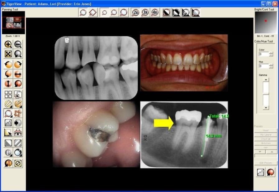 Medical software / for dental imaging TigerView DENTAL TigerView