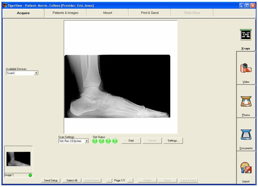 Diagnostic software / viewing / medical / medical imaging TigerView