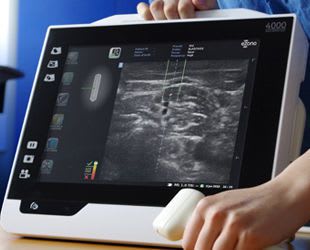 Portable ultrasound system / for emergency medecine ultrasound imaging / touchscreen eZono 4000 eZono