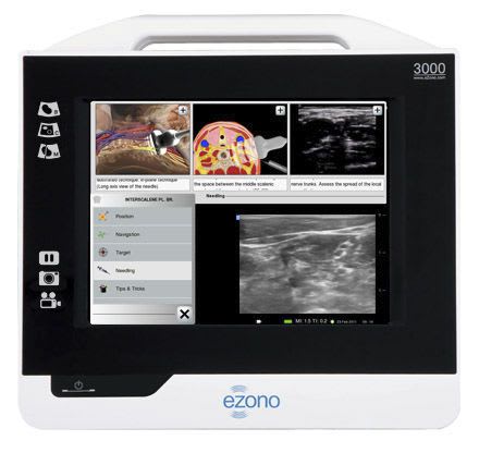 Portable ultrasound system / for anesthesias and intensive care ultrasound imaging / touchscreen eZono™ 3000 eZono