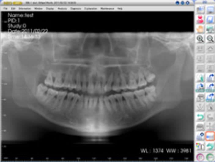 Image capture software / for dental imaging NEO 3D ASAHI Roentgen