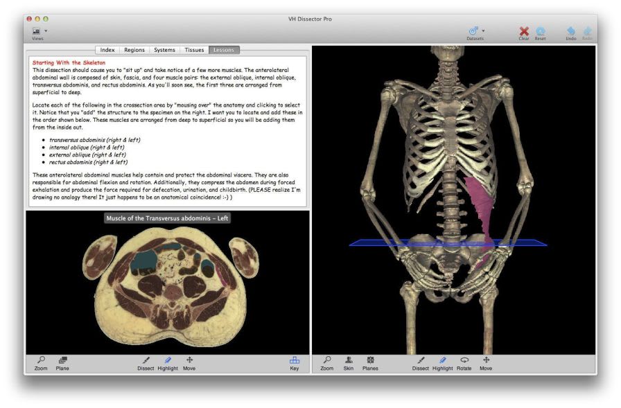 Training software / anatomy VH Dissector for Undergraduate Education TolTech