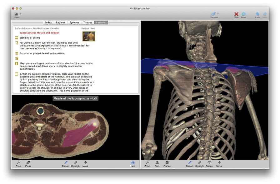 Training software / physical therapy / medical VH Dissector for Physical Therapy Education TolTech