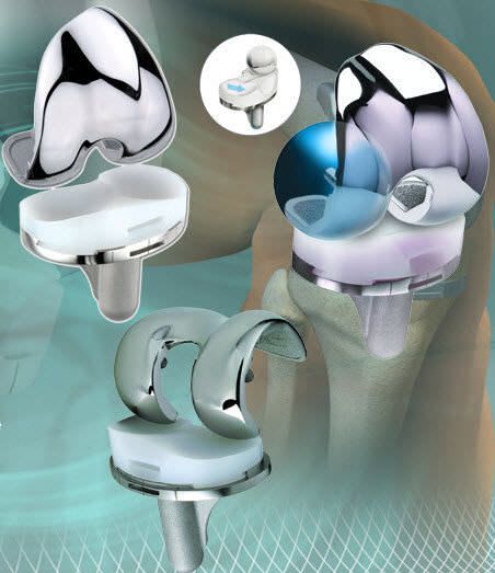 Three-compartment knee prosthesis / traditional ADVANCE® Shanghai Microport Orthopedics Co.,Ltd