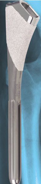 Traditional femoral stem / cemented PROFEMUR® RENAISSANCE® Shanghai Microport Orthopedics Co.,Ltd
