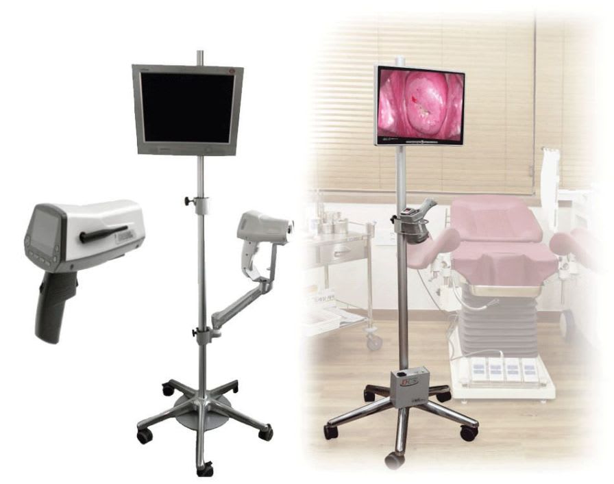 Video colposcope / mobile / with video monitor Dr. Cervicam ® WiFi NTL