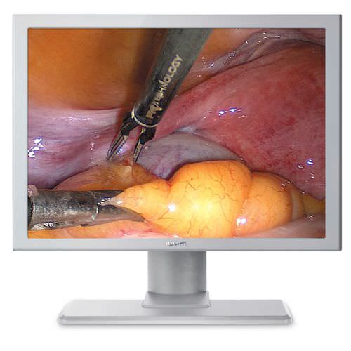 High-definition display / endoscopy / surgical 19" | JUSHA-ES19B Nanjing Jusha Display Technology Co.,Ltd