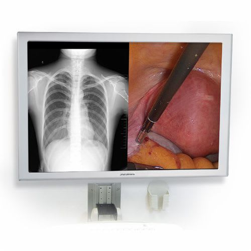 High-definition display / surgical / endoscopy 42" | JUSHA-ES42 Nanjing Jusha Display Technology Co.,Ltd