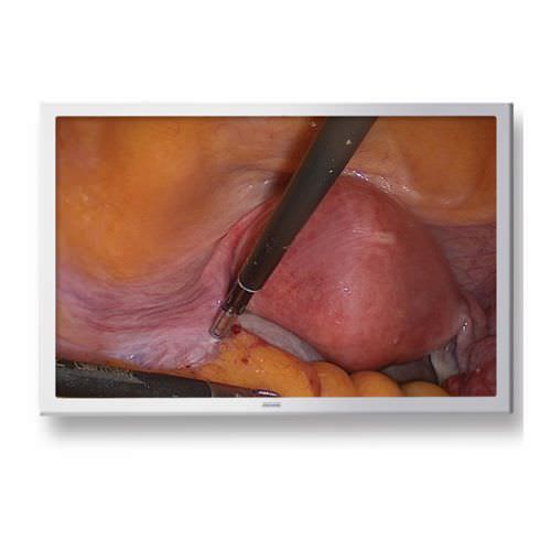 High-definition display / surgical / endoscopy JUSHA-ES22 Nanjing Jusha Display Technology Co.,Ltd