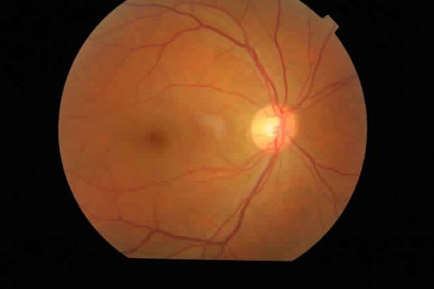 Non-mydriatic retinal camera (ophthalmic examination) / eye fluorescein angiography TRC-NW8 Topcon Europe Medical