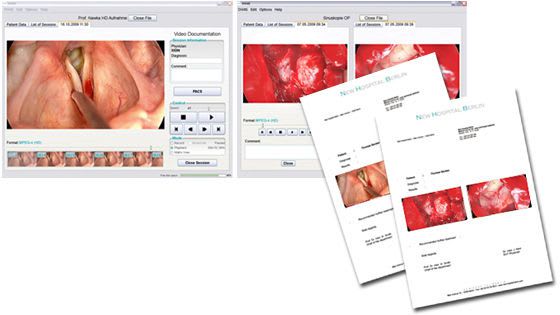 Viewing software / medical / for endoscopy DiVAS HD XION