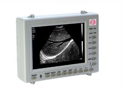 Hand-held ultrasound system / for gynecological and obstetric ultrasound imaging CUS-2000 CAREWELL