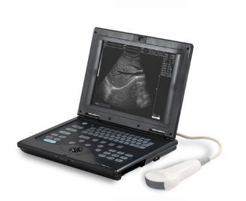 Portable ultrasound system / for multipurpose ultrasound imaging CUS-2018 CAREWELL
