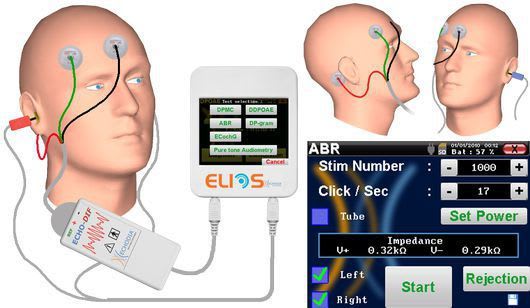 Evoked auditory potential measurement system (audiometry) / digital ABR Echodia