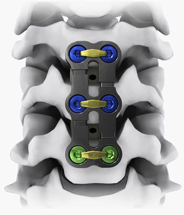 Cervical arthrodesis plate / anterior / 2 levels KINETIC® Life Spine