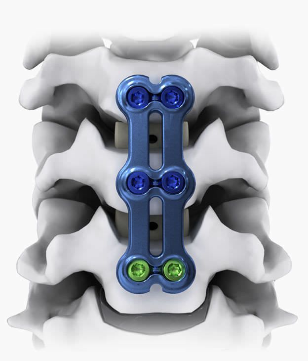 Cervical arthrodesis plate / anterior / 2 levels NEO®-SL Life Spine