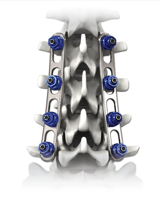 Thoraco-lumbar spinal osteosynthesis unit / posterior PILOT®-P Life Spine