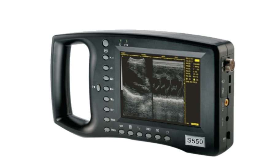 Hand-held ultrasound system / for multipurpose ultrasound imaging S550 Sino-Hero