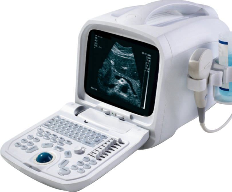 Portable ultrasound system / for multipurpose ultrasound imaging S990 Sino-Hero