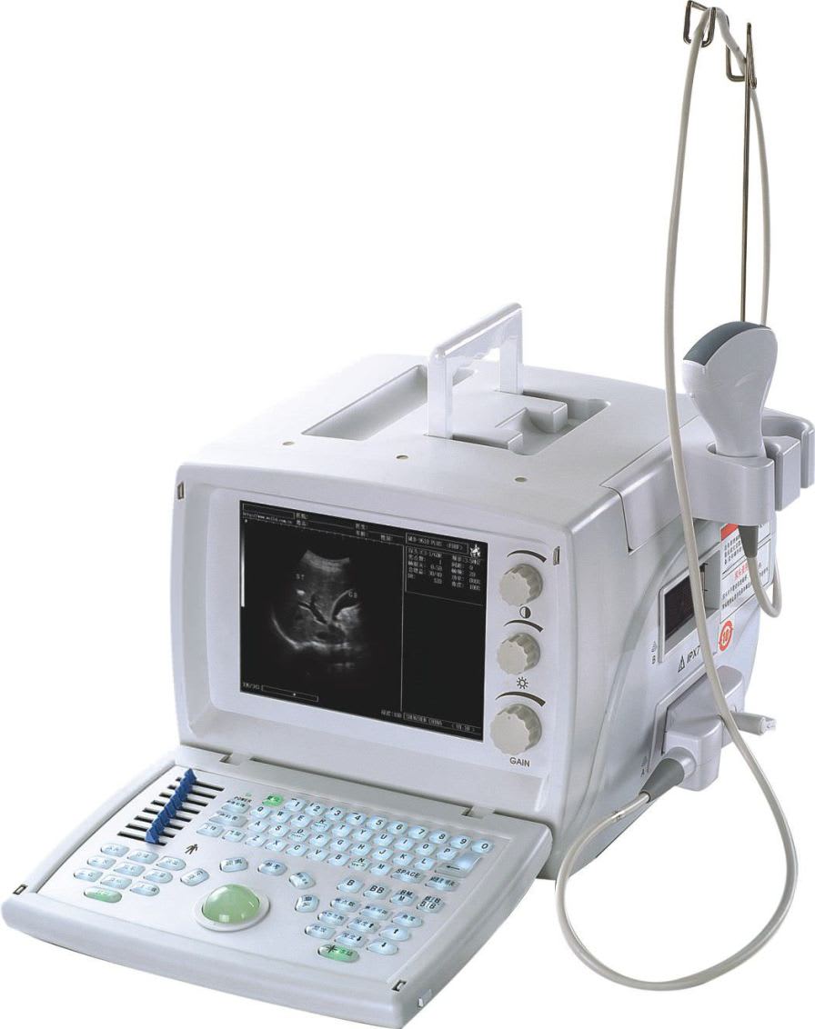 Portable ultrasound system / for multipurpose ultrasound imaging S880 Sino-Hero