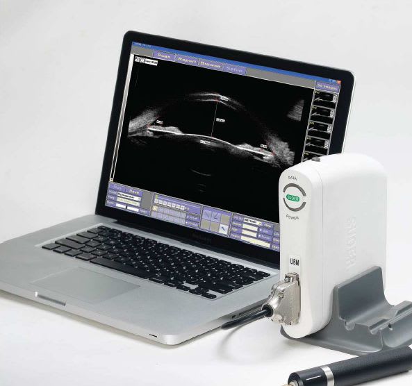 Portable ultrasound system / for ophthalmic ultrasound imaging SW-2000/SW-2100 Tianjin Suowei Electronic Technology