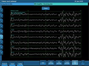 Portable electroencephalograph CNS Moberg Research