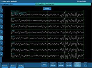 Portable electroencephalograph CNS Moberg Research