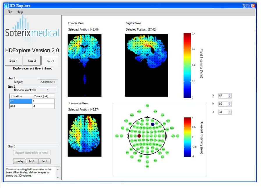 Neurophysiological stimulation software / medical HD-Explore™ Soterix Medical