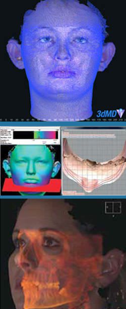 Facial modeling software / surgery / surgery / for plastic surgery 3dMDvultus 3dMD