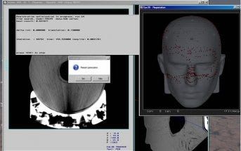 3D viewing software / surgical navigation / for neuroimaging TRACKER MEVIS Informática Médica