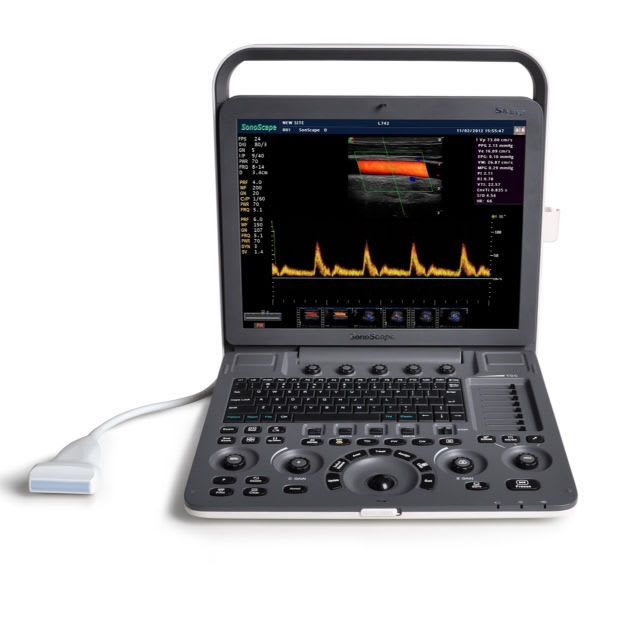 Vascular access doppler / portable S8Exp SonoScape Company