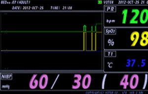 SpO2 vital signs monitor / TEMP / NIBP VP-700SNT VOTEM