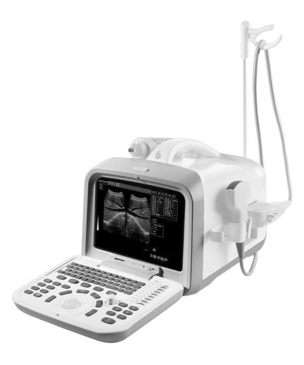 Portable ultrasound system / for multipurpose ultrasound imaging ZQ-6600 Zoncare Electronics
