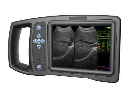 Hand-held veterinary ultrasound system i30vet Zoncare Electronics
