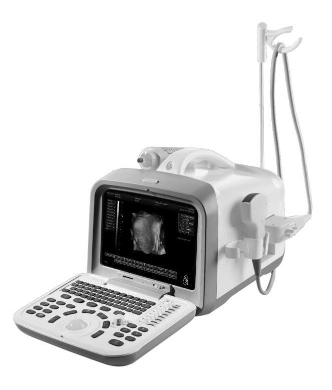Portable ultrasound system / for multipurpose ultrasound imaging ZQ-6602 Zoncare Electronics