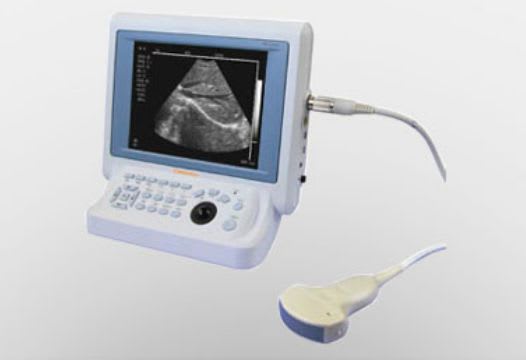 Hand-held ultrasound system / for gynecological and obstetric ultrasound imaging HD 6300 Caresono