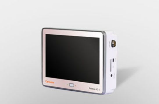 Portable ultrasound bladder scanner PADSCAN HD3 Caresono