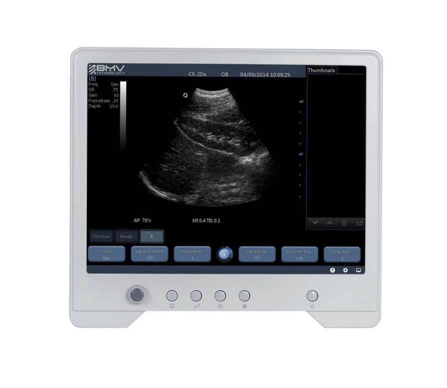 Portable veterinary ultrasound system TouchScan® TS20VET BMV Technology