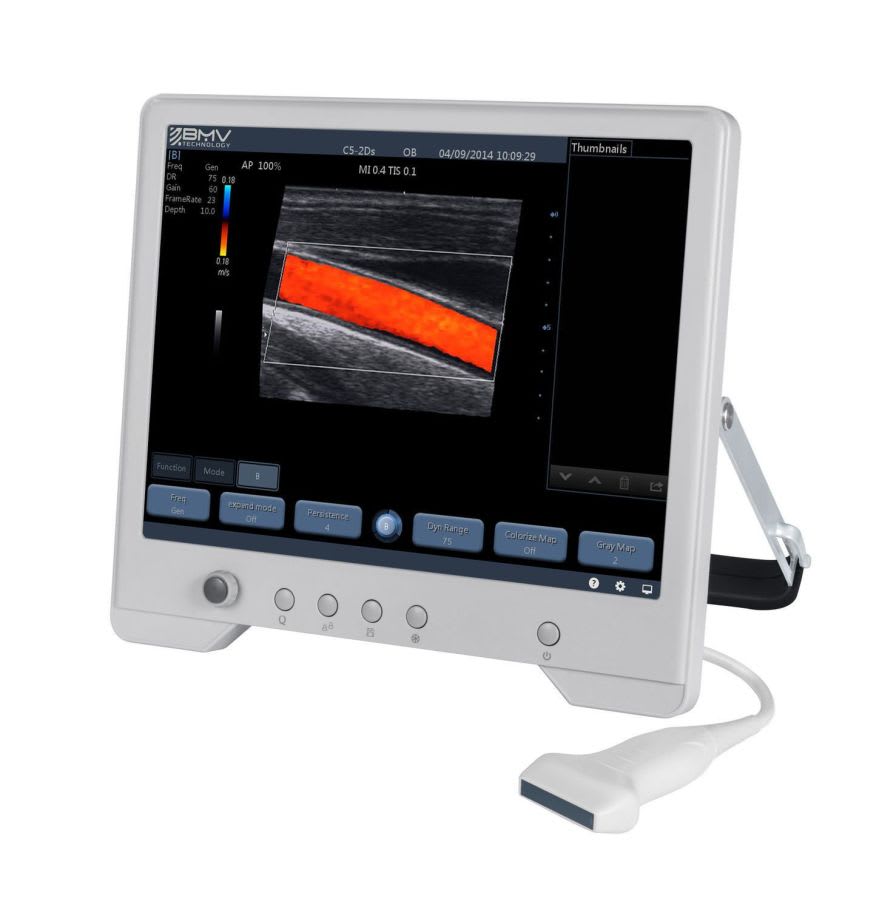 Portable veterinary ultrasound system TouchScan® TS30B Pro BMV Technology
