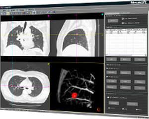 Viewing software / analysis / medical / CT NeuLungCARE Neusoft Medical Systems