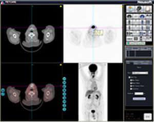 Analysis software / CT / PET / medical PETCARE Neusoft Medical Systems