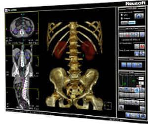 Analysis software / viewing / CT / urology UroCARE Neusoft Medical Systems