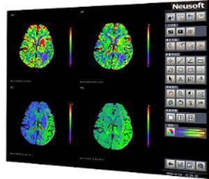 Analysis software / diagnostic / import / medical CT Perfusion Neusoft Medical Systems