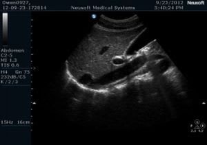 Ultrasound system / on platform / for multipurpose ultrasound imaging N7 Neusoft Medical Systems