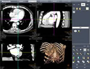 Analysis software / viewing / medical / MRI BW Neusoft Medical Systems